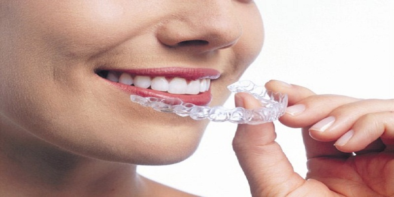 Is Invisalign Better Than Traditional Braces?